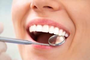 Gum Disease Prevention