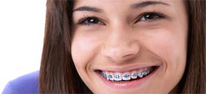 Adolescent Orthodontics