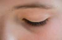 Sedation Dentist Illinois